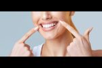 professional teeth whitening brighter smile results