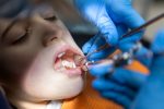 a child is getting tooth extractions treatment from dentist
