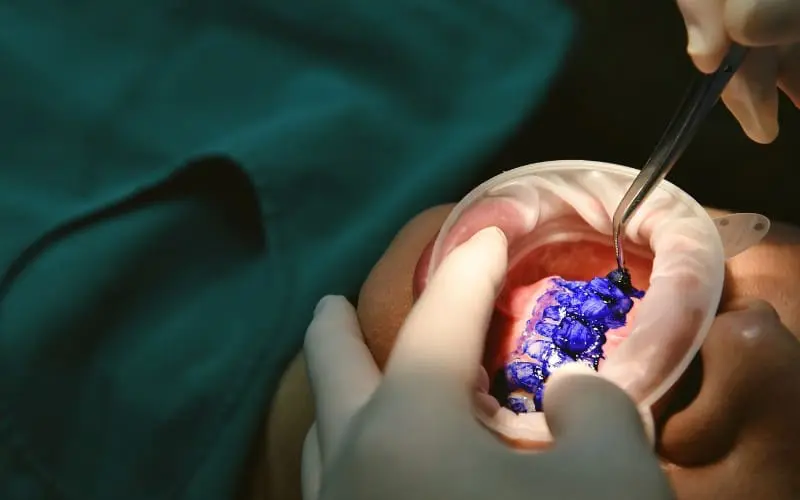 guided biofilm therapy downtown calgary