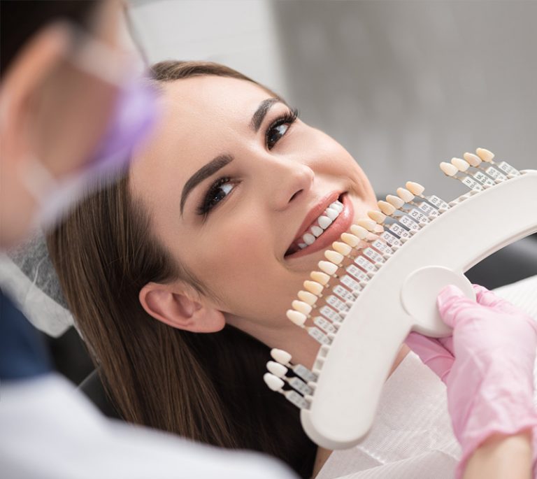 a woman is testing suitable porcelain veneers on her teeth