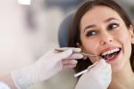 things-you-do-not-know-about-dental-fillings