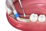 dental clinic in lloydminster