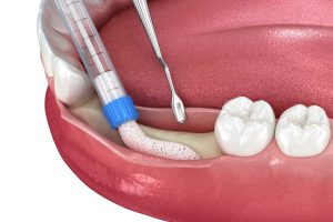 dental clinic in lloydminster
